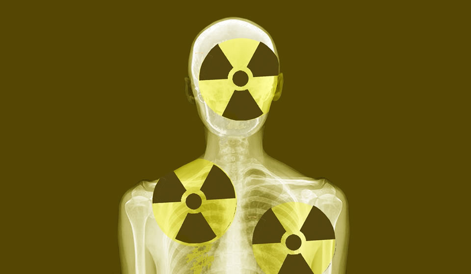 Efectos de la Radiación sobre el Cirujano