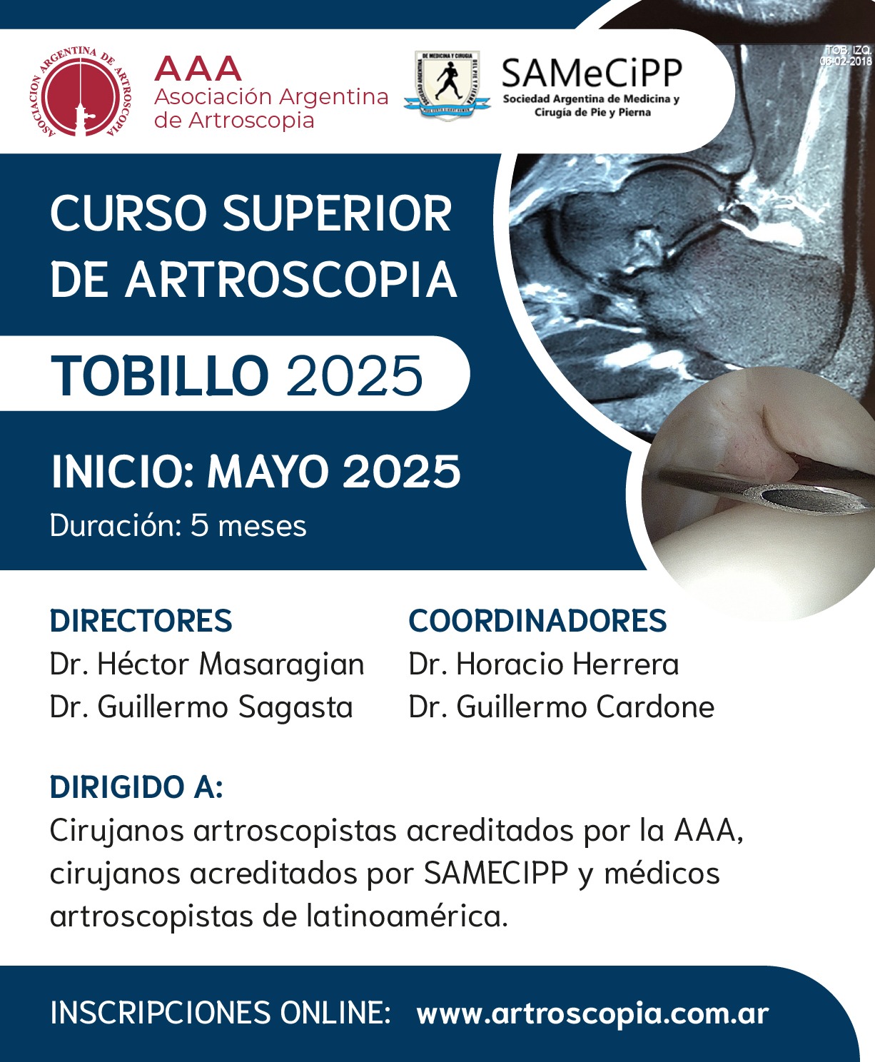 Curso Superior de Artroscopia de Tobillo 2025